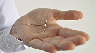 Would an IUD or birth control implant work for me?