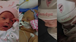 2 stories, 4 babies: Support and care for complex twin pregnancies