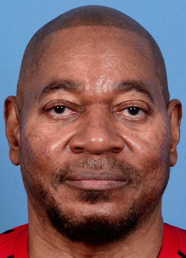 post photo of a man getting skin treatments