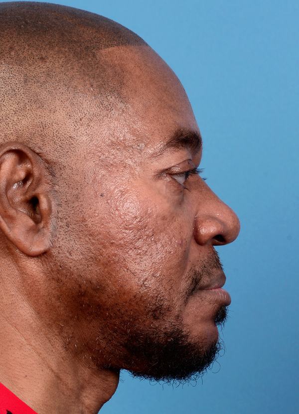 post photo of a man getting skin treatments