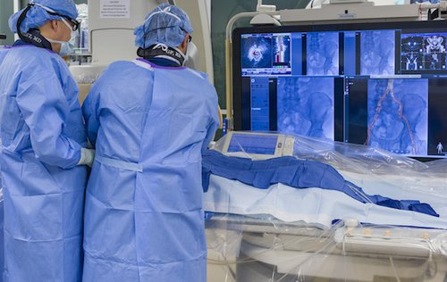 Improving treatment for abdominal aortic aneurysm – without open ...