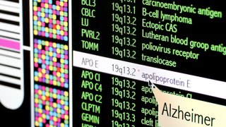 What genetic testing can reveal about your Alzheimer's disease risk