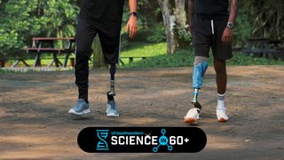 Anchored in hope: Osseointegrated implants boost mobility for amputees