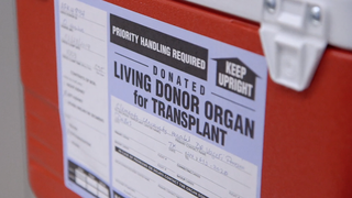 Dual epidemics in Texas: Navigating kidney transplantation during COVID-19