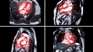 Advances in cardiac imaging open big window into the heart