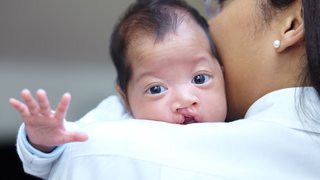What parents need to know about cleft lip and palate