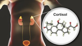 How the ‘stress hormone’ cortisol contributes to Cushing syndrome