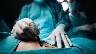 The true cost of discount plastic surgery