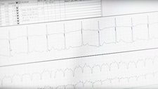6 key heart tests and what they show | UTSW Medblog