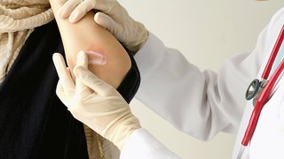 Skin lymphoma: Rare cancer, strange symptoms, effective treatments