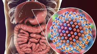 Hepatitis C treatment can cut risk of liver-related death by 50% for patients with a history of liver cancer