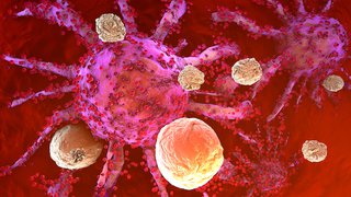 New immunotherapy can prevent kidney cancer recurrence after surgery: Is it right for you?