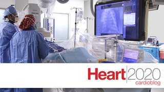 Transradial angioplasty – a handy fix for blocked coronary arteries