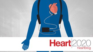 LVADs no longer just a bridge, but a long-term alternative to heart transplant