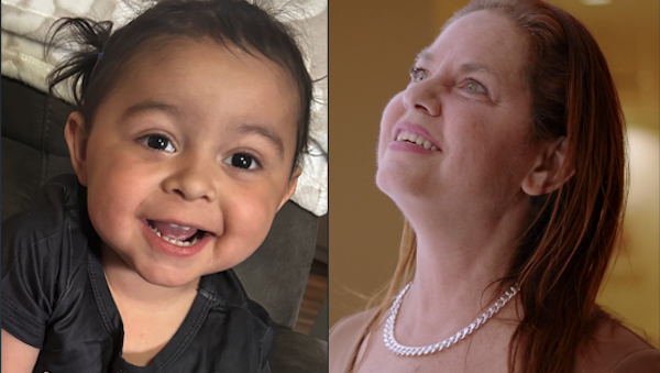 Divide and survive: How a split-liver transplant saved two lives