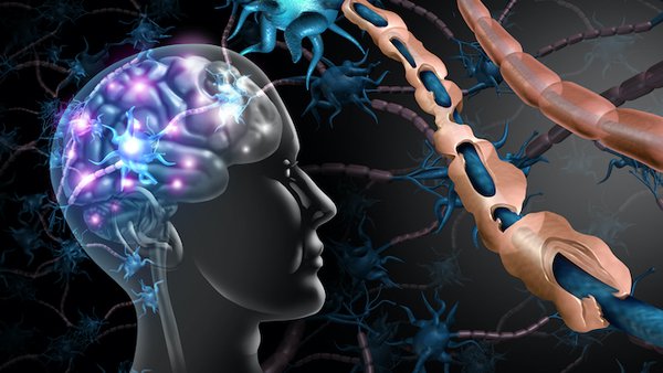 Multiple sclerosis spotlight: Early diagnosis and better treatments, now and in the future
