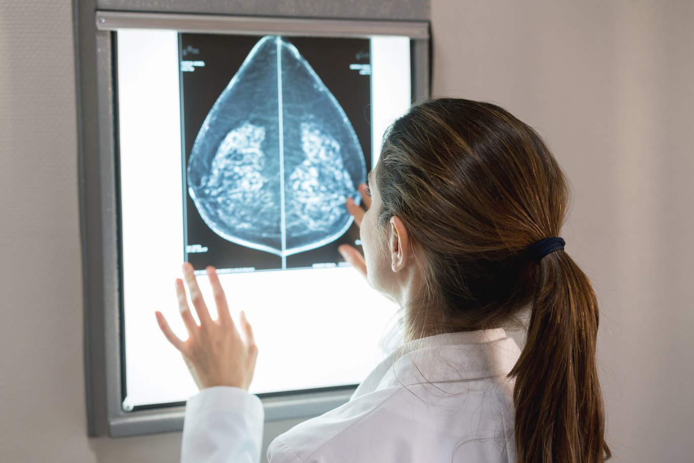Breast Imaging Mammography Clinic - UT Southwestern
