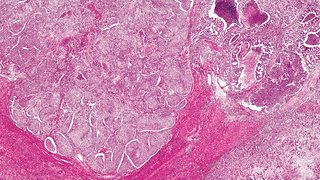 Targeting Phosphatidylserine to Boost Immunotherapy Activity