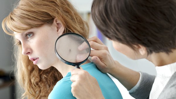 What does skin cancer look like? Pictures, plus prevention tips