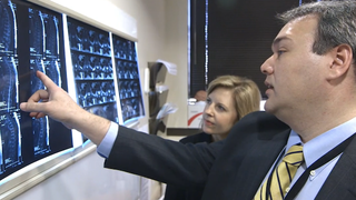 Transverse myelitis: When inflammation damages the spinal cord ‘wiring’