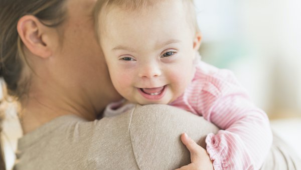6 things to expect with babies with Down syndrome