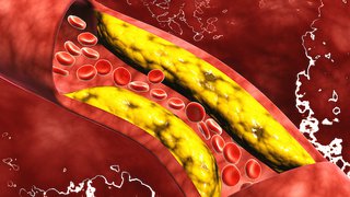 Pregnancy, statins, and high cholesterol: What women need to know
