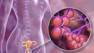 Answers to 6 burning questions about yeast infection during pregnancy