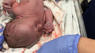What does your baby’s Apgar score mean?