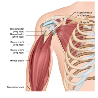 Pain in the arm? Tips to heal biceps tendonitis without surgery ...