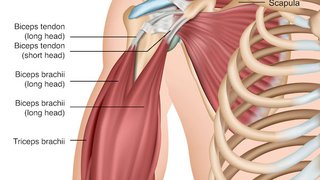 Biceps tendonitis: How arthroscopic surgery relieves shoulder pain, reduces scarring