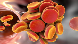Walking a fine line: How managing blood clots might change heart attack prevention