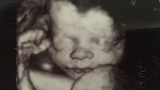 Womb with a view: Sensory development in utero