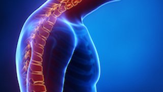 Find relief from four common spinal deformities – often without surgery