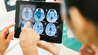 4 major advancements in brain surgery since 2000