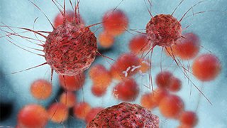 New genetic test for breast cancer may be unable to keep promises