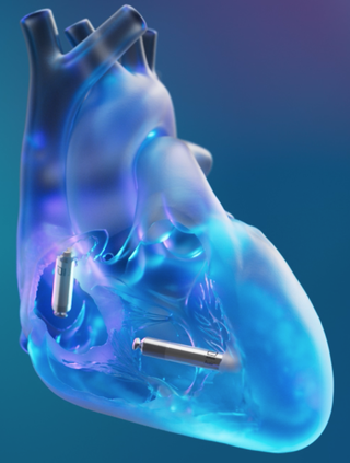 Leadless dual-chamber pacemaker is a leap forward for heart patients ...