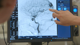 See the signs of a stroke, save a life