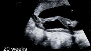 Feeling your baby move during pregnancy