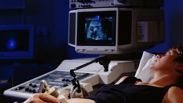 Fetal echocardiogram: What to expect