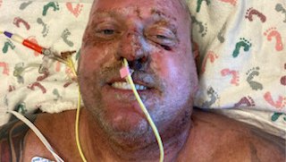 Captain Indestructible: Dallas firefighter rises from the ashes and returns to job he loves