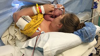 ‘Gentle C-sections’: Bringing a traditional birth experience to the OR