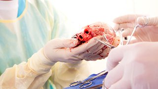 Victories and tears: How the heart transplant team holds it together