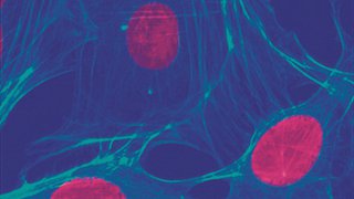 Incubating Progress: Imaging/Brain Cancer