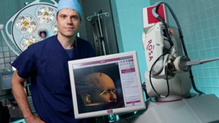 Meet ROSA, a new precision tool for seizure treatment