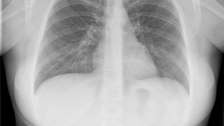 Schedule a mammogram – for your heart?
