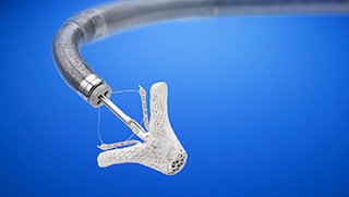 New ‘clip’ helps people too old, too sick for open-heart surgery