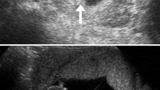 What to expect when you’re expecting twins – or more