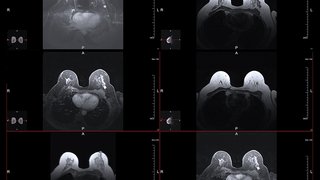 Ushering Breast Cancer Into a New Era of Collaborative Care