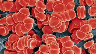 How can having low platelets affect my pregnancy and birth plan?