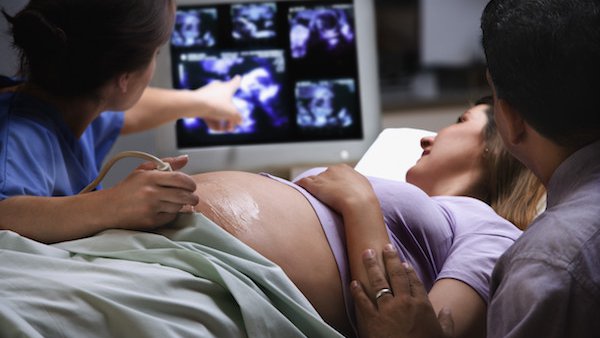 Down syndrome in pregnancy: A new chapter in your family’s story